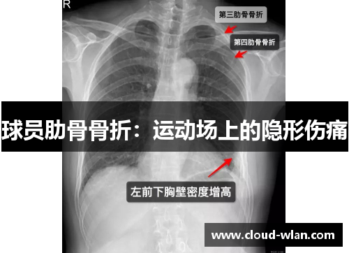 球员肋骨骨折：运动场上的隐形伤痛